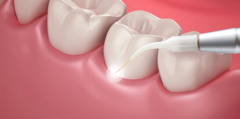 tooth getting work